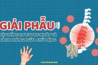 Giải phẫu hệ thống cơ xương khớp và cách phòng ngừa chủ động
