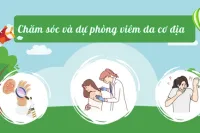 Chăm sóc và dự phòng viêm da cơ địa
