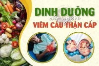 Dinh dưỡng cho người viêm cầu thận cấp